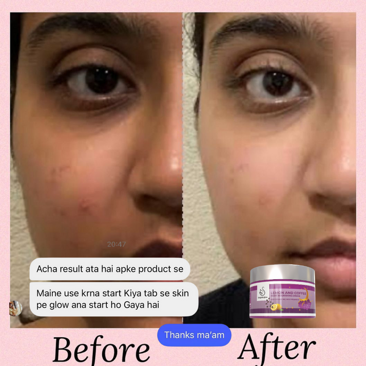 Vitamin C Serum 1 Pack + Day and Night Glow Cream ( Combo ) 2 Pack one is Day cream and second one is Night cream🔥🔥 FOR FIRST 100 CUSTOMERS ONLY
